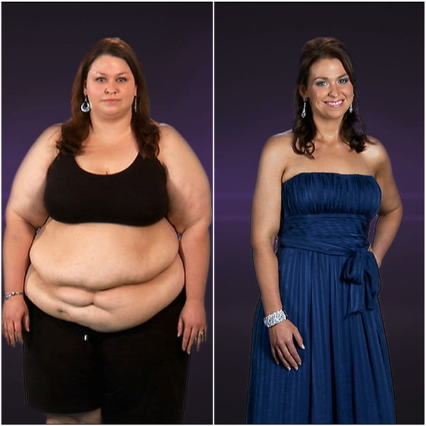 Extreme Makeover Tv Show Weight Loss